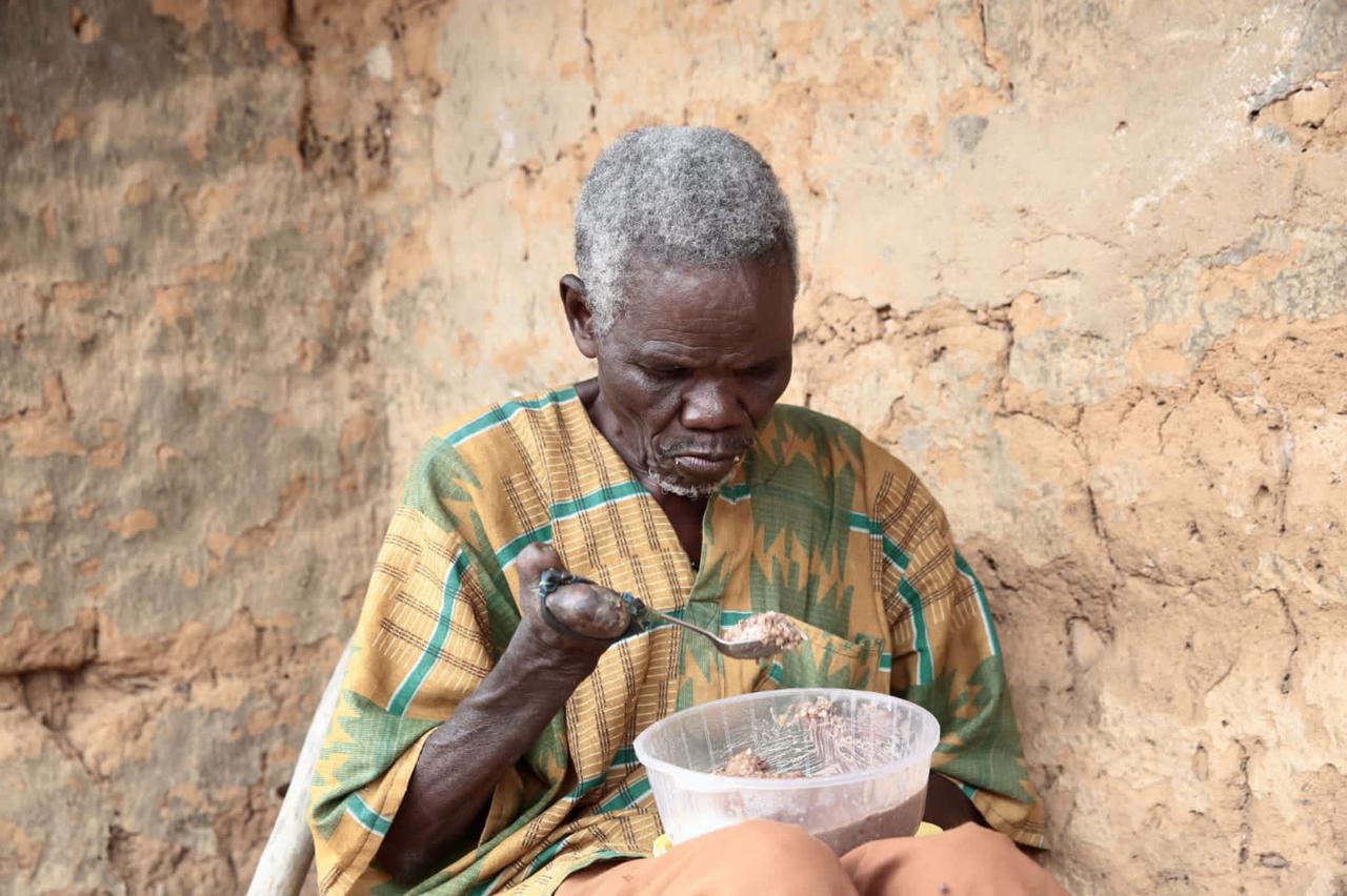 REDRESS Project - People affected by Leprosy finding it difficult to eat.